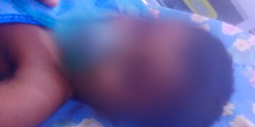 Noticias para migrantes Ecuatorianos Niño, de cuatro años, muere en Tiwintza por picadura de alacrán. No recibió el antídoto